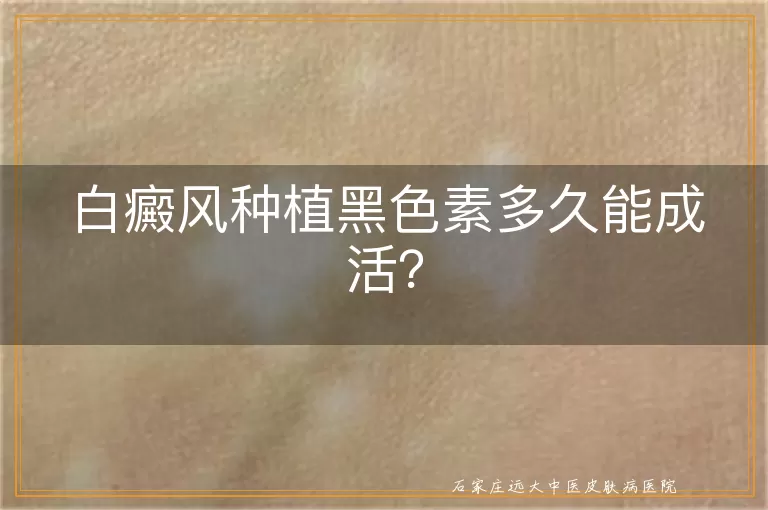 白癜风种植黑色素多久能成活？