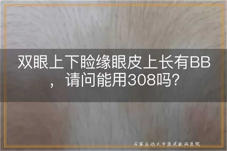 双眼上下睑缘眼皮上长有BB，请问能用308吗？