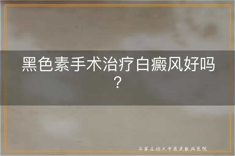 黑色素手术治疗白癜风好吗？