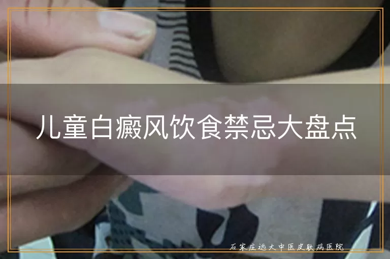 儿童白癜风饮食禁忌大盘点