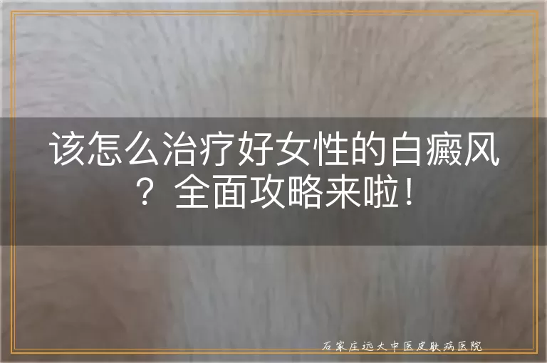 该怎么治疗好女性的白癜风？全面攻略来啦！