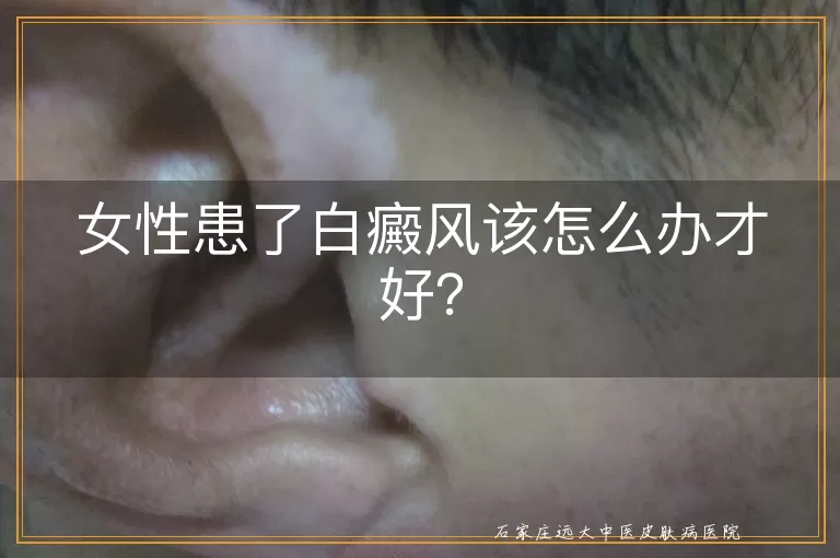 女性患了白癜风该怎么办才好？