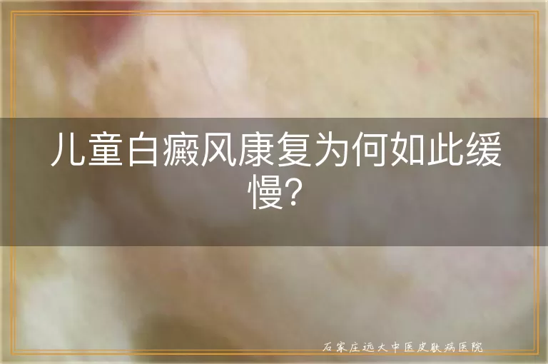 儿童白癜风康复为何如此缓慢？