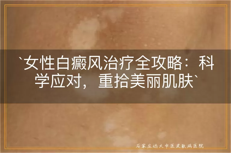 女性白癜风治疗全攻略：科学应对，重拾美丽肌肤