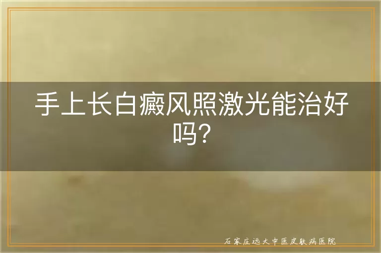手上长白癜风照激光能治好吗？