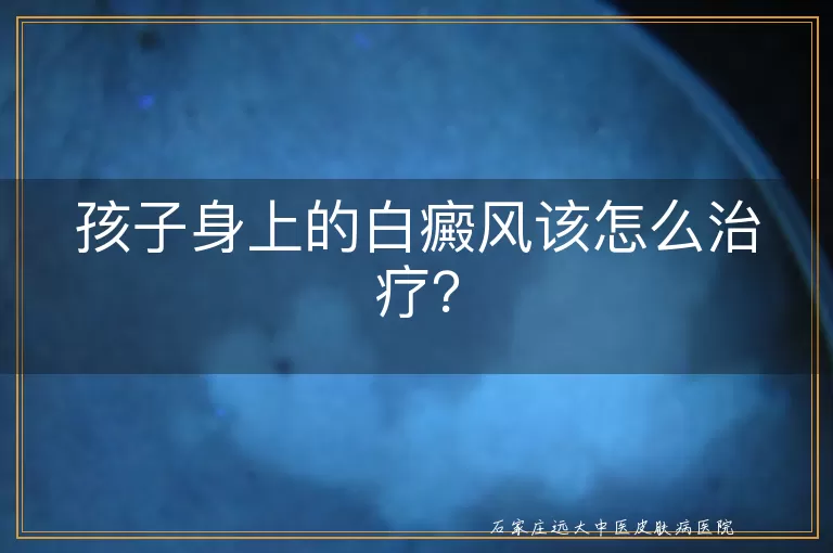 孩子身上的白癜风该怎么治疗？