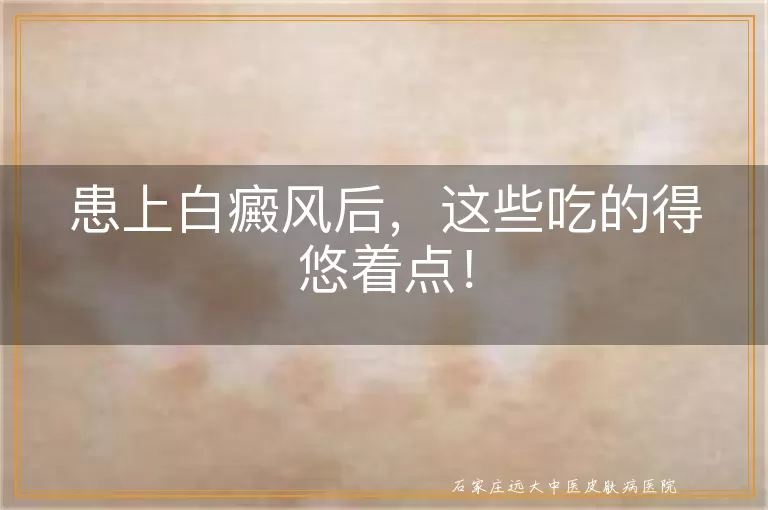 患上白癜风后，这些吃的得悠着点！