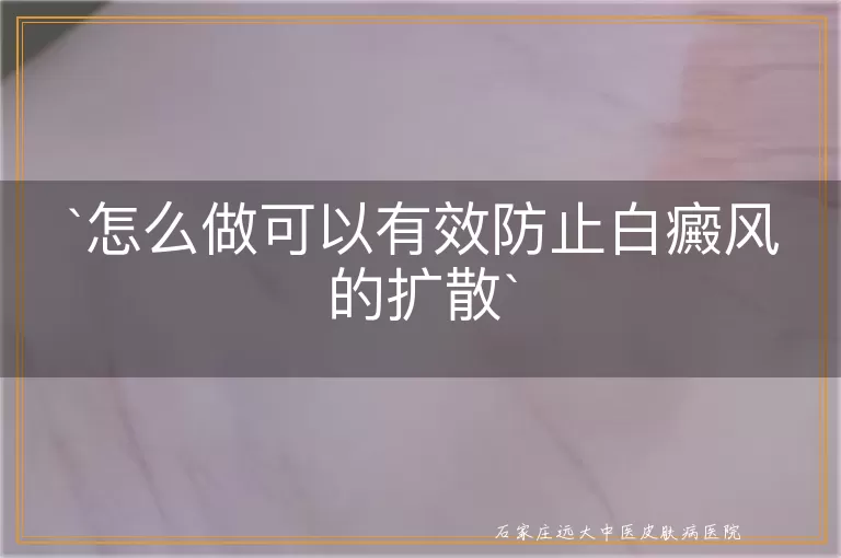 怎么做可以有效防止白癜风的扩散
