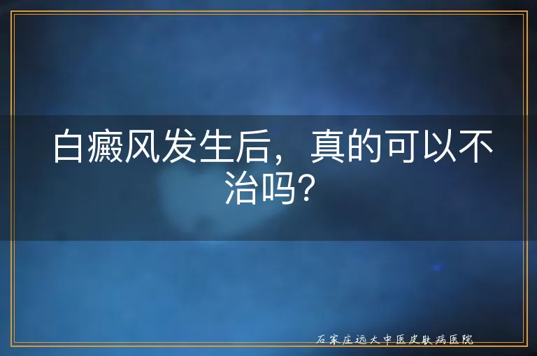 白癜风发生后，真的可以不治吗？