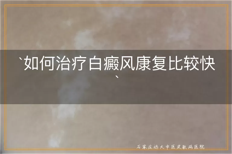 如何治疗白癜风康复比较快