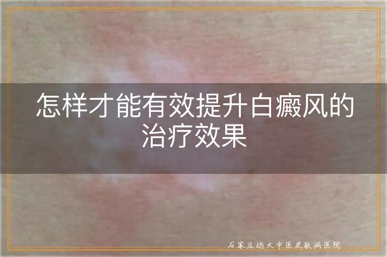 怎样才能有效提升白癜风的治疗效果