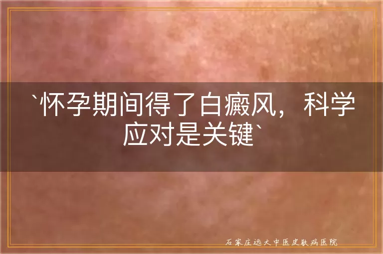 怀孕期间得了白癜风，科学应对是关键