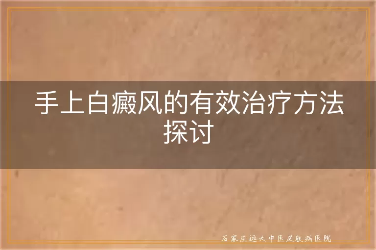手上白癜风的有效治疗方法探讨