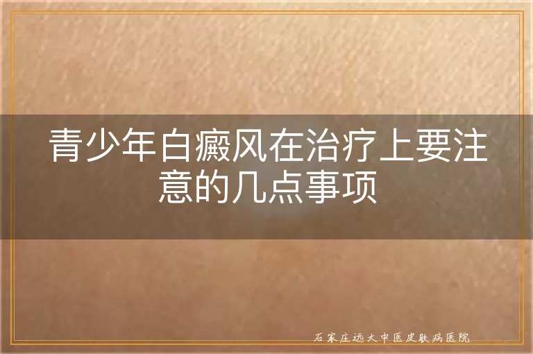 青少年白癜风在治疗上要注意的几点事项