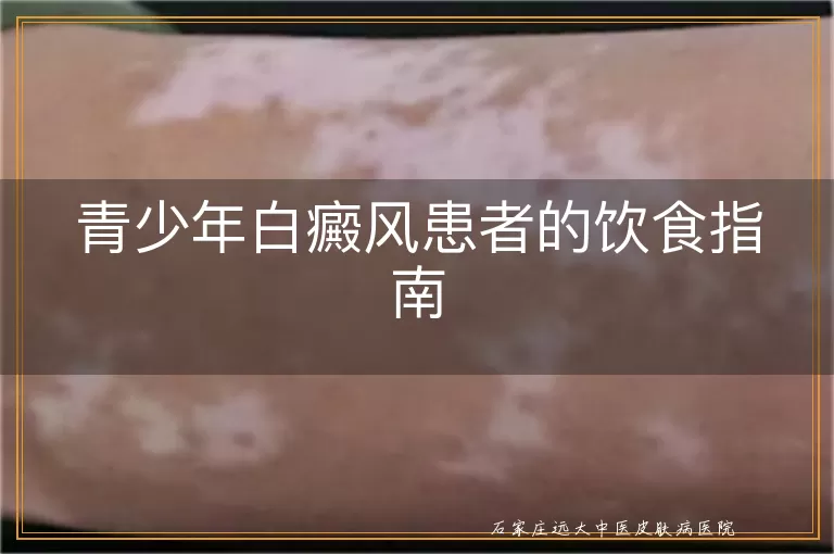 青少年白癜风患者的饮食指南