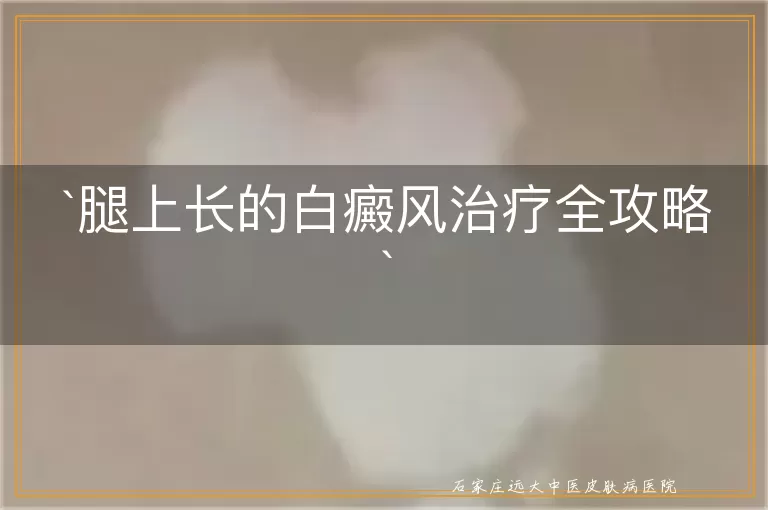 腿上长的白癜风治疗全攻略