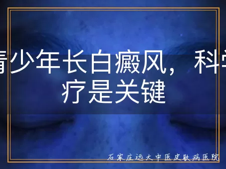小青少年长白癜风，科学治疗是关键