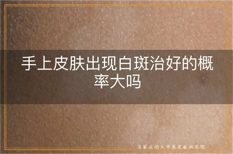 手上皮肤出现白斑治好的概率大吗