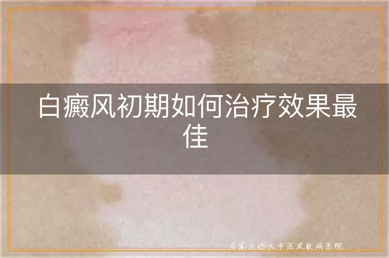 白癜风初期如何治疗效果最佳