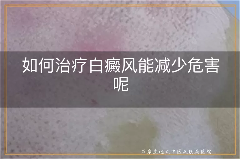 如何治疗白癜风能减少危害呢
