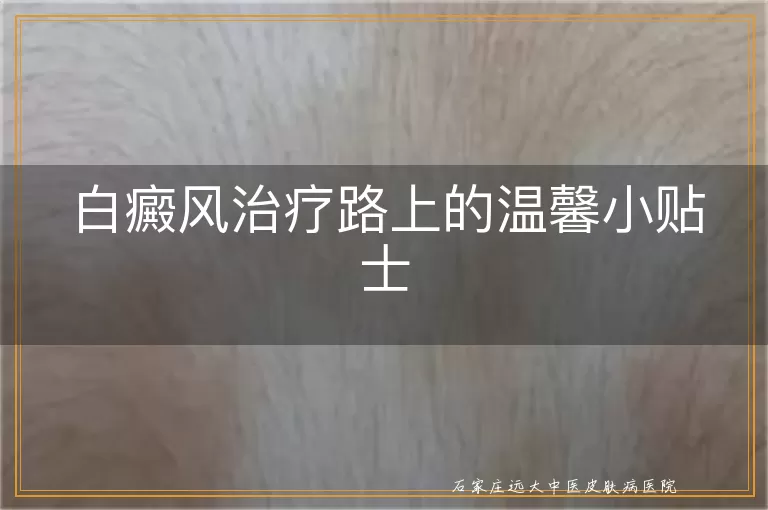 白癜风治疗路上的温馨小贴士