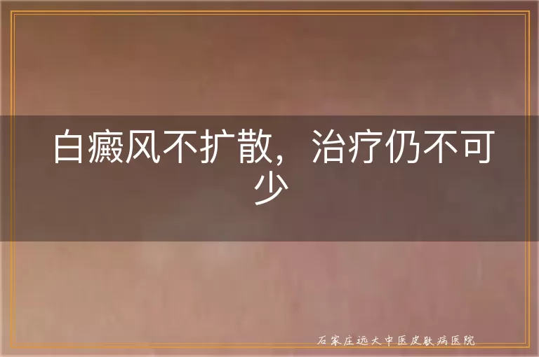 白癜风不扩散，治疗仍不可少