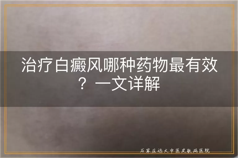 治疗白癜风哪种药物最有效？一文详解