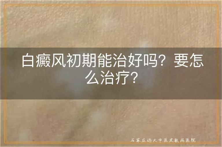 白癜风初期能治好吗？要怎么治疗？