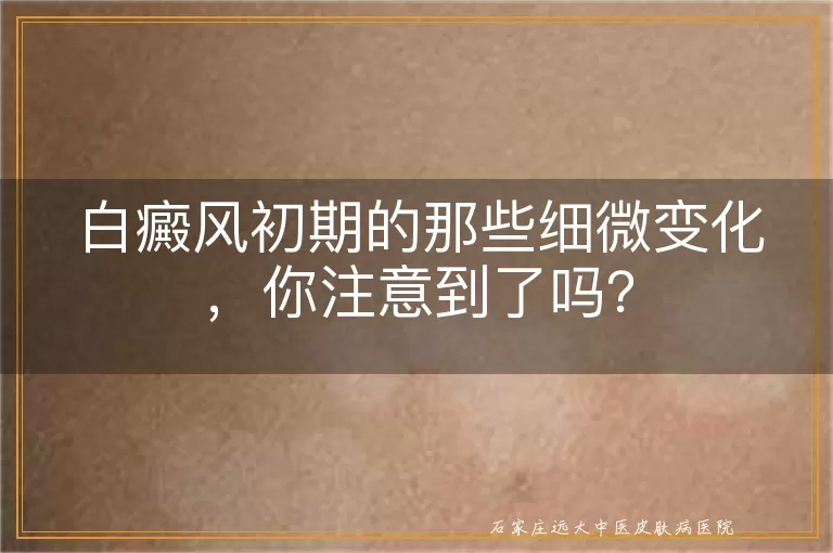白癜风初期的那些细微变化,你注意到了吗?