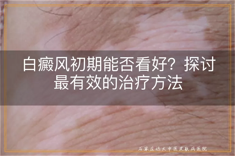 白癜风初期能否看好？探讨最有效的治疗方法