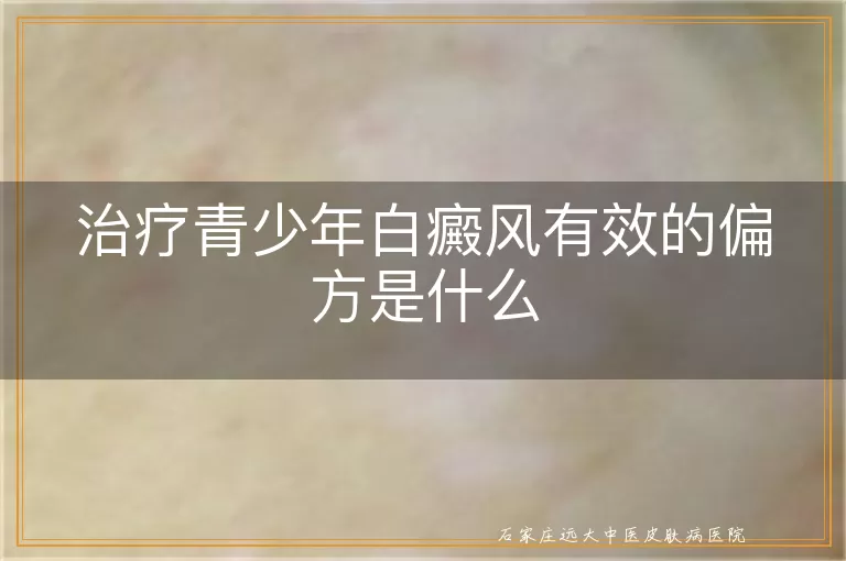 治疗青少年白癜风有效的偏方是什么