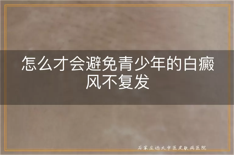 怎么才会避免青少年的白癜风不复发