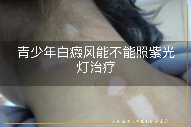 青少年白癜风能不能照紫光灯治疗
