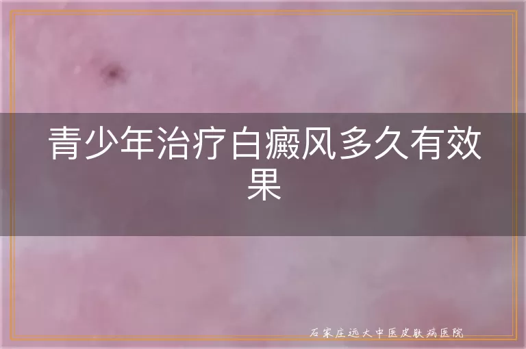 青少年治疗白癜风多久有效果