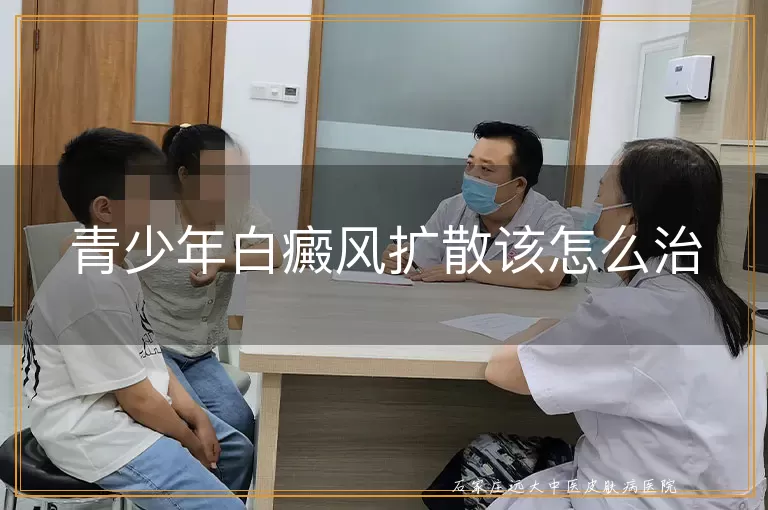 青少年白癜风扩散该怎么治