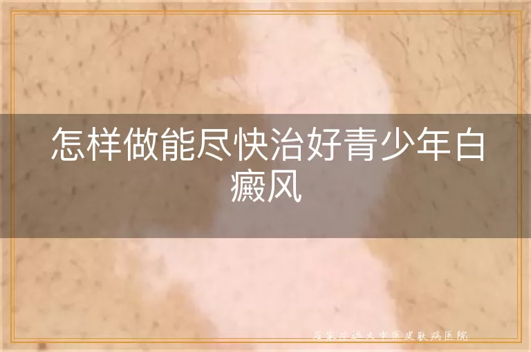 怎样做能尽快治好青少年白癜风