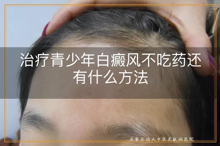 治疗青少年白癜风不吃药还有什么方法