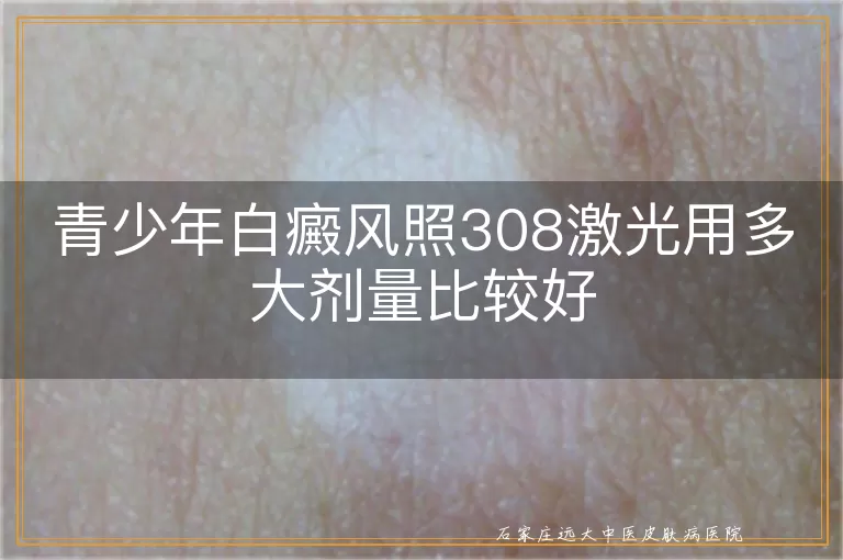 青少年白癜风照308激光用多大剂量比较好