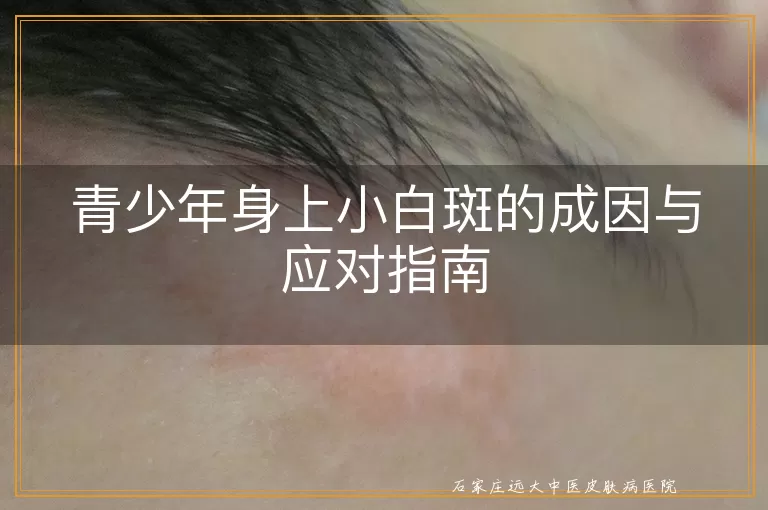青少年身上小白斑的成因与应对指南