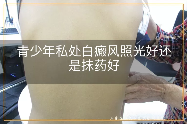 青少年私处白癜风照光好还是抹药好