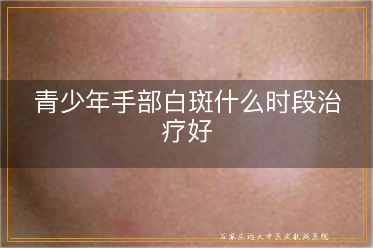 青少年手部白斑什么时段治疗好