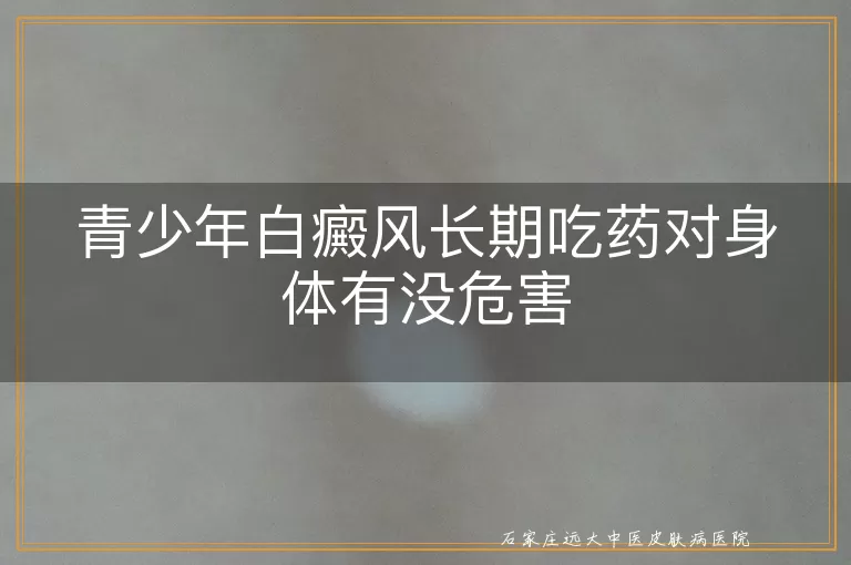 青少年白癜风长期吃药对身体有没危害