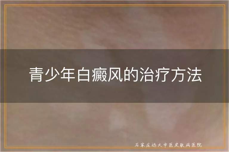 青少年白癜风的治疗方法