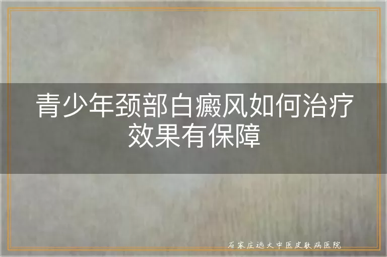 青少年颈部白癜风如何治疗效果有保障
