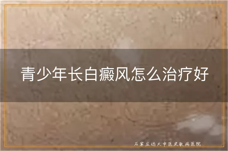 青少年长白癜风怎么治疗好