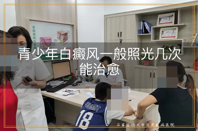 青少年白癜风一般照光几次能治愈
