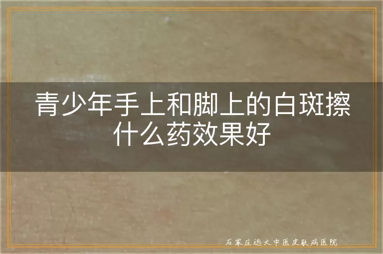 青少年手上和脚上的白斑擦什么药效果好