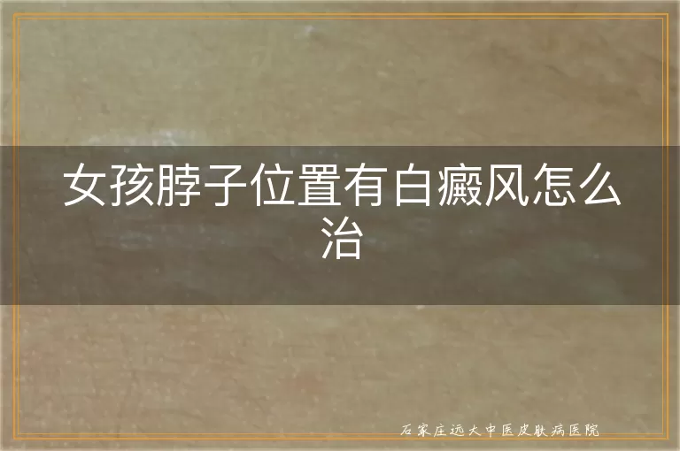 女孩脖子位置有白癜风怎么治