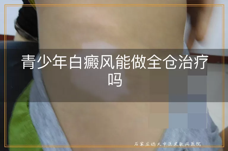 青少年白癜风能做全仓治疗吗