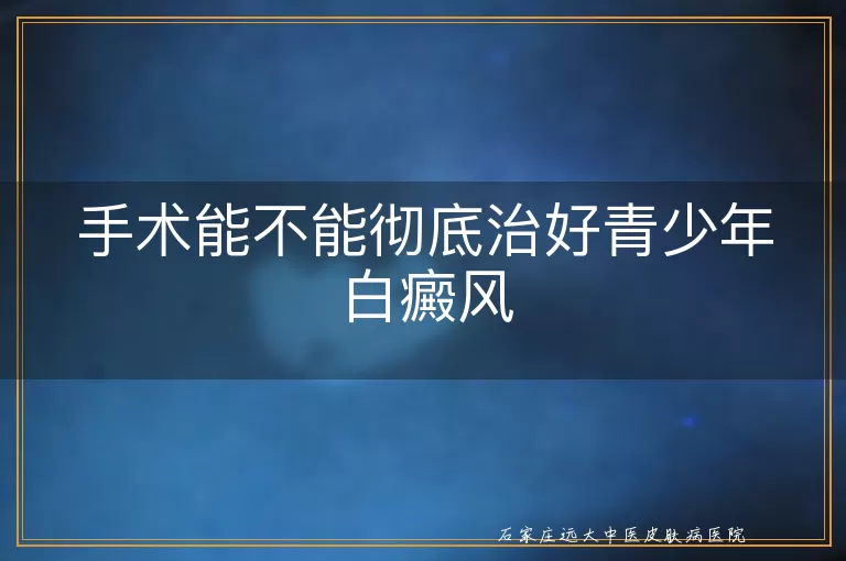 手术能不能彻底治好青少年白癜风
